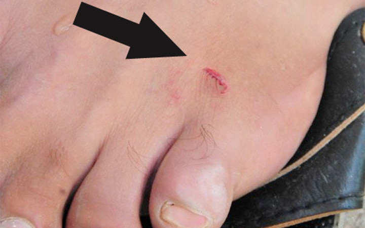 Adana'da pirana balığı baraj gölünde dehşet saçtı