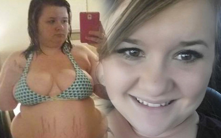 Eski sevgilisinden intikamını acı acı aldı değişimi hayrete düşürdü