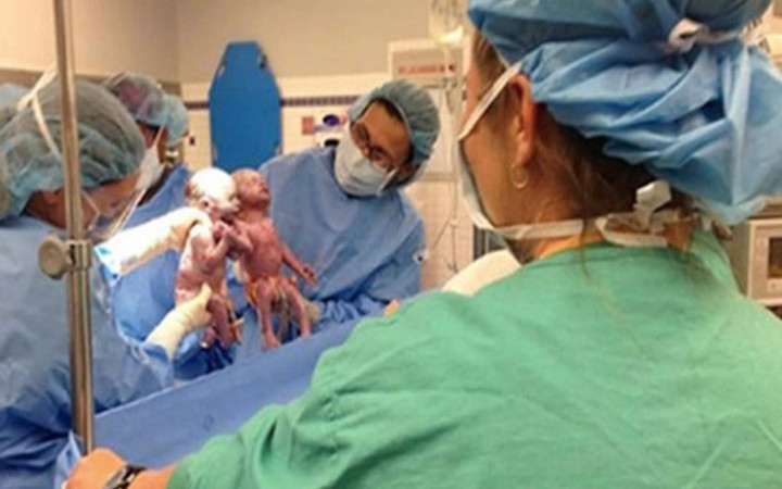 Bebekler doğduğunda olanları görenler gözlerine inanamadı 