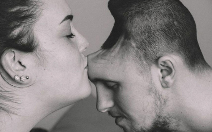 İçtiği şey yüzünden kafasının yarısını kaybetti görenler inanamıyor