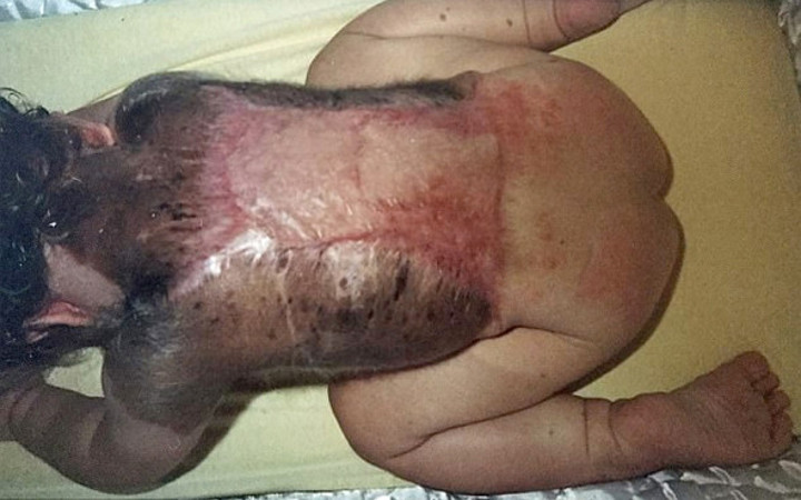 Bebek simsiyah dünyaya geldi doktorlar bile şaştı kaldı