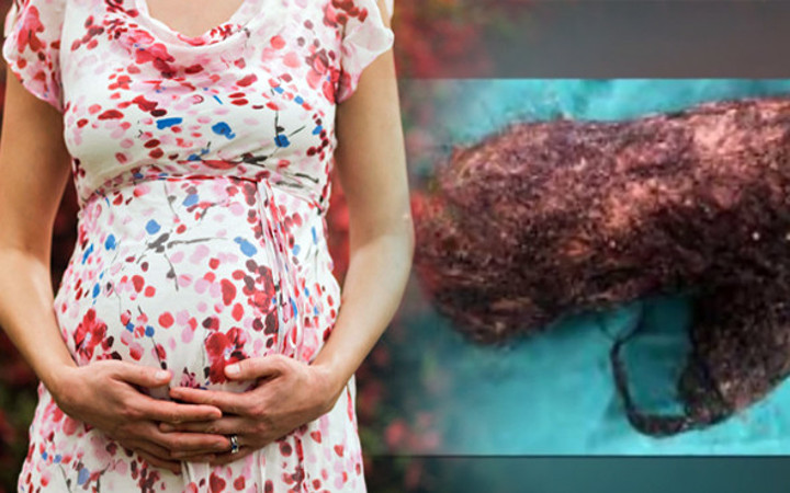 Hamileyim diye doktora gitti karnından çıkanlar şoke etti