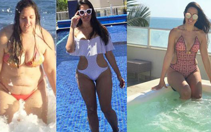 Obezdi güzellik kraliçesi oldu