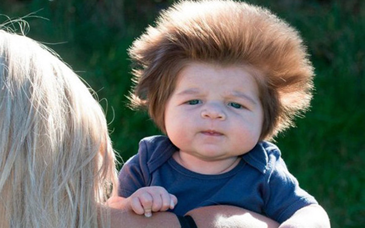 Saçlarıyla fenomen olmuştu bir de son haline bakın saç kalmadı