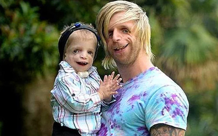 Ailesi onu gördüğü anda terk etti bir milyoner evlatlık aldı ve...