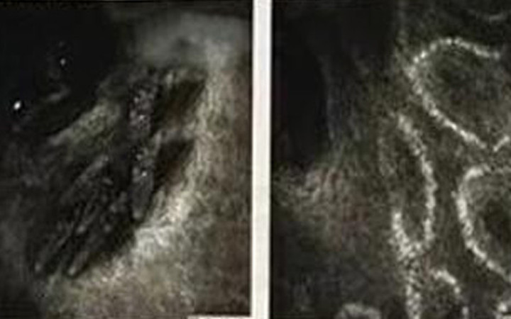 Gözünden ne çıktığını duyunca hayret edeceksiniz