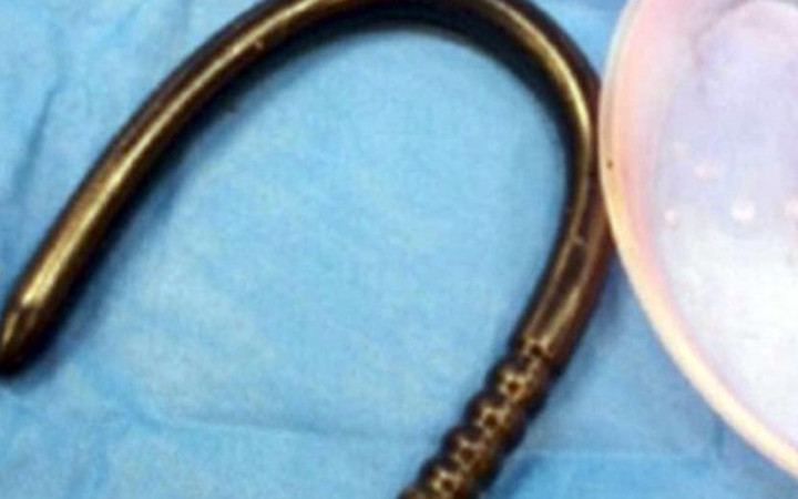 Akıllara durgunluk veren olay sarhoş adamın anüsünden bu çıktı