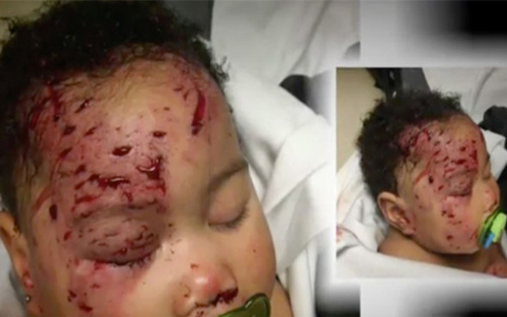 Uyumak için bıraktı geri döndüğünde ise bu halde buldu