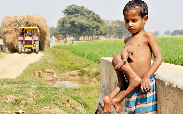Onlar 4 bacakla dünyaya geldi görünce şoke olacaksınız