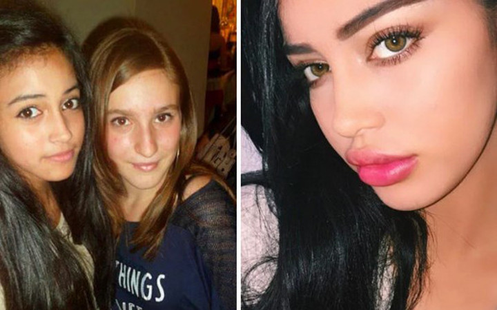 Fenomen olmak için estetik yaptırıyorlar