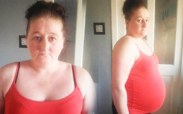 Hamile değil karnındaki şey mide bulandırıcı!