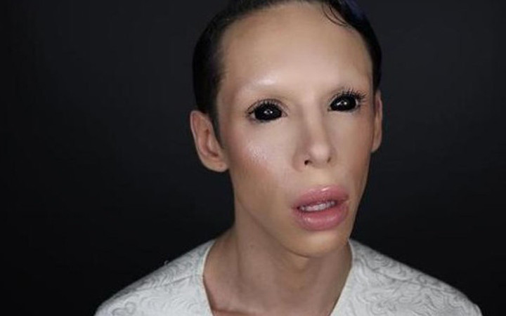 Cinsiyetsiz olmak için 110 ameliyat geçirdi