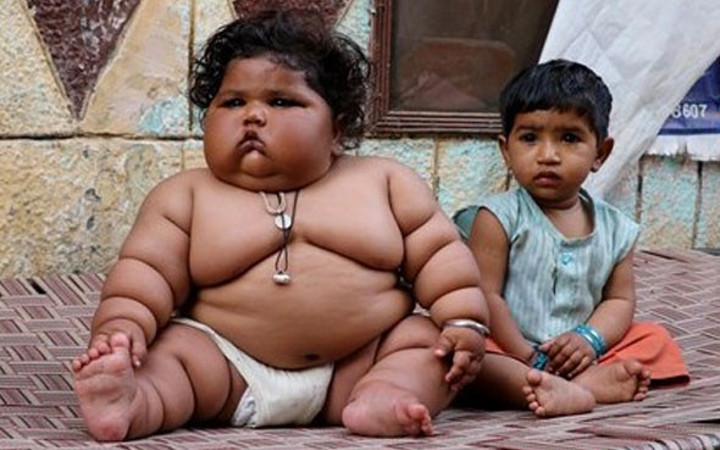 Bu bebek 8 aylık! 4 yaşındaki çocukla aynı kiloda