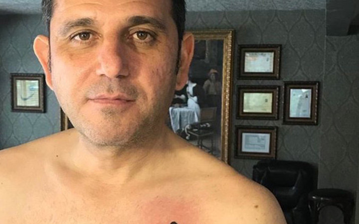 Fatih Portakal dövme yaptırdı capsler patladı