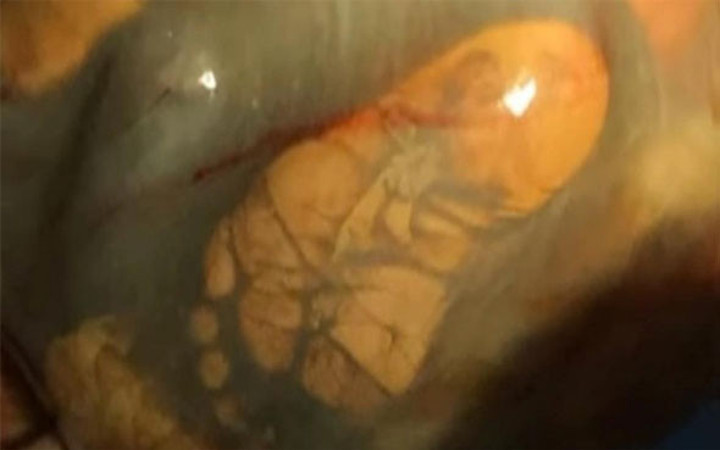 41 Haftalık hamileydi doktora gitmedi ama muayene edilince...