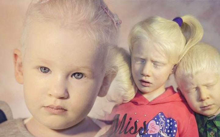 Onlar Türkiye'nin beyaz melekleri gören bir acayip bakıyor