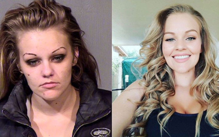 17 yaşından beri uyuşturucu kullanan genç kızın son hali şoke etti!