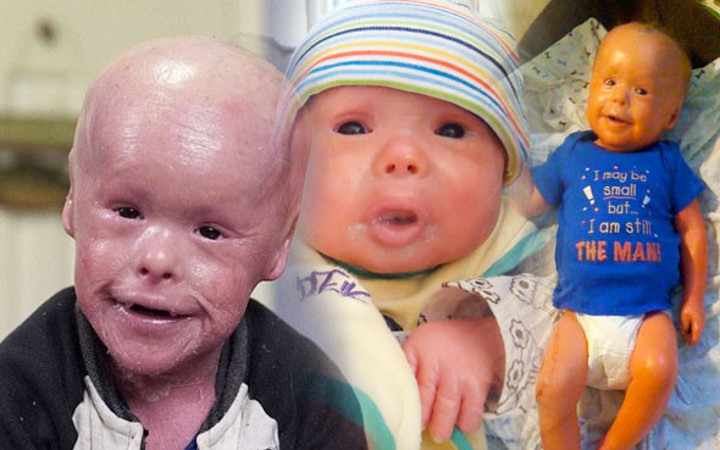 Dünya bu bebeği konuşuyor gelmiş geçmiş en garip hastalık!