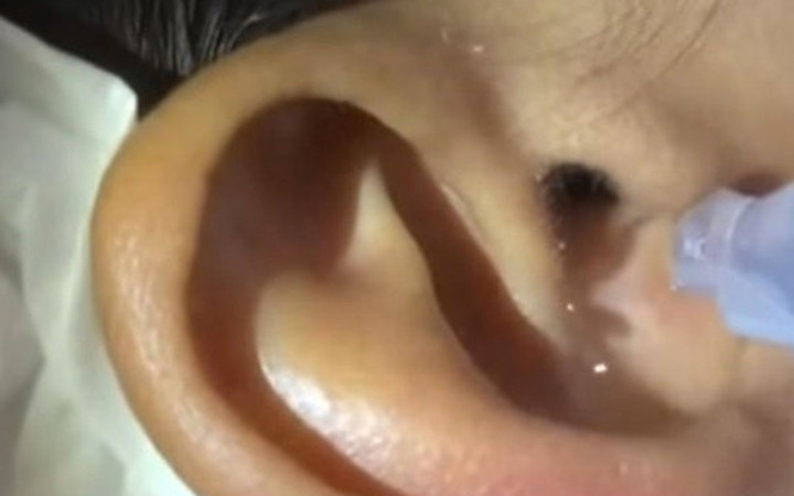 Kulak ağrısı şikayetiyle gitti içinden çıkana bakın