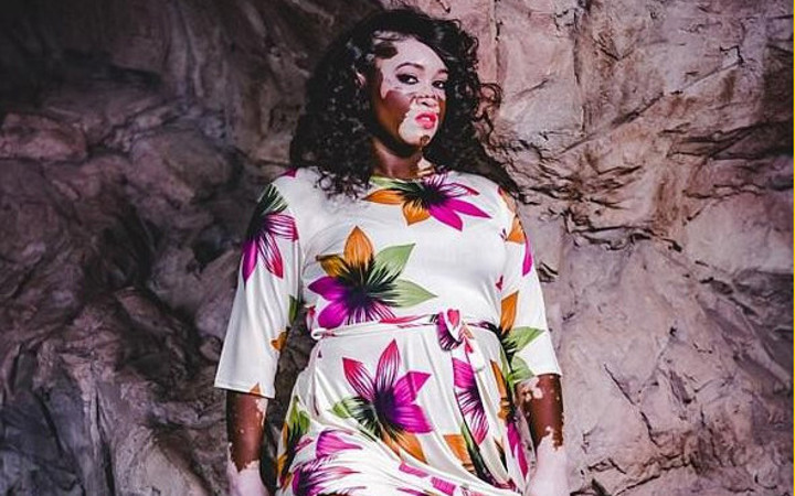 Herkes dalga geçiyordu şimdi dünya peşinde