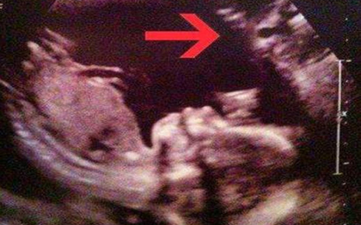 Bebeğin yanında bir de kedi bekliyorlar