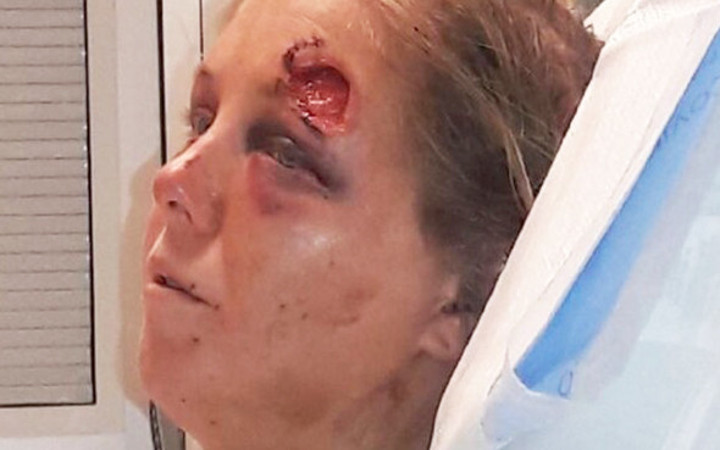 Arkadaşlarına kendi kız arkadaşına tecavüz etmelerini önerdi iğrenç olay