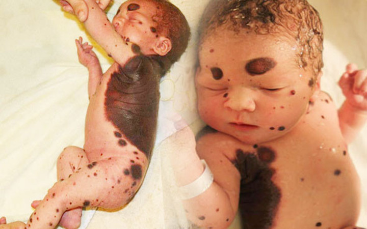 Bebek bu halde doğdu anne baba şoke oldu gerçekler ortaya çıkınca...