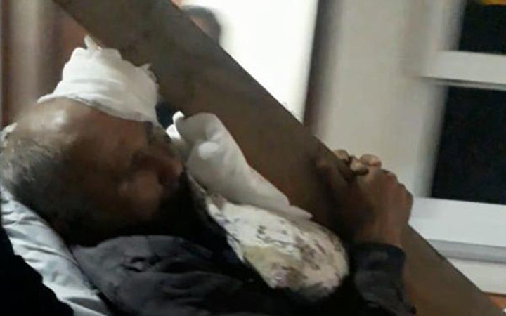 Çatıdan söktüğü kalastaki çivi başına saplandı