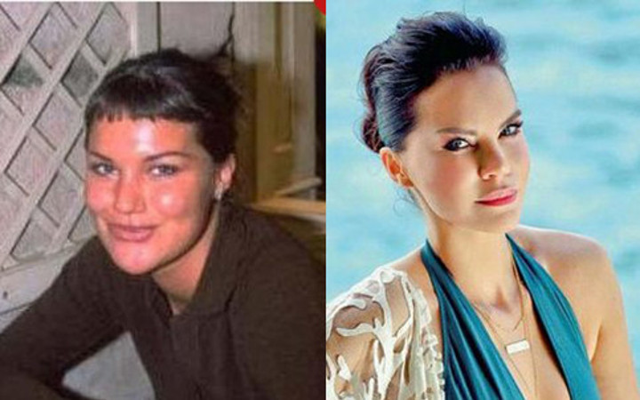 Ünlülerin inanılmaz  değişimleri