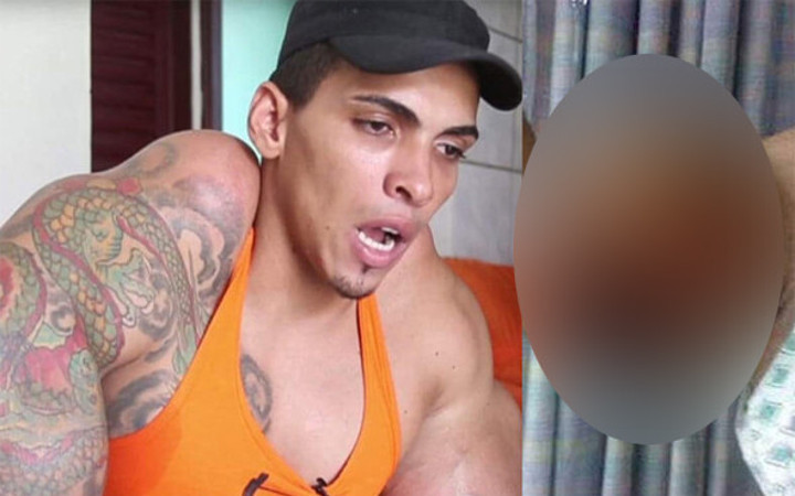 Kas yapacağım derken kolu patladı öyle bir halde ki...