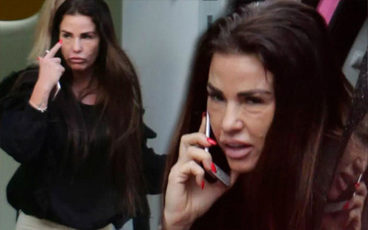 Yara bere içinde! Katie Price'ın yüzü tanınmaz hale geldi