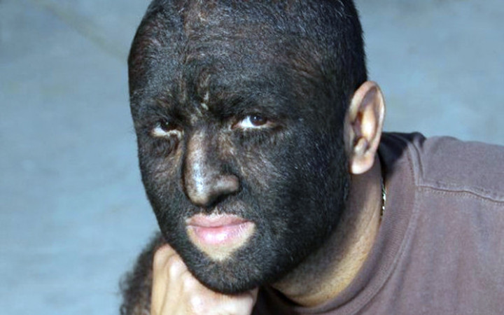 Makyaj falan değil tamamen gerçek!