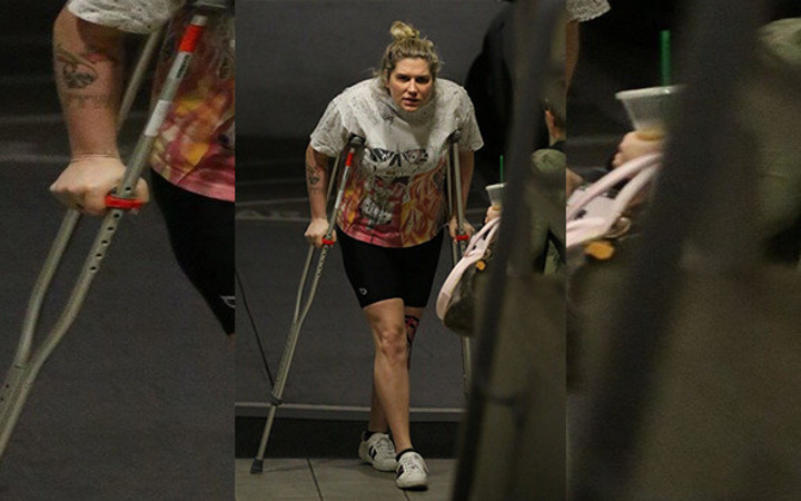 Ünlü şarkıcı görenleri şoke etti ne oldu böyle!