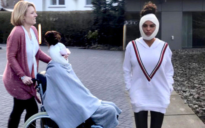 Ünlü şarkıcının son hali korkuttu! Güzellik uğruna bu yapılır mı