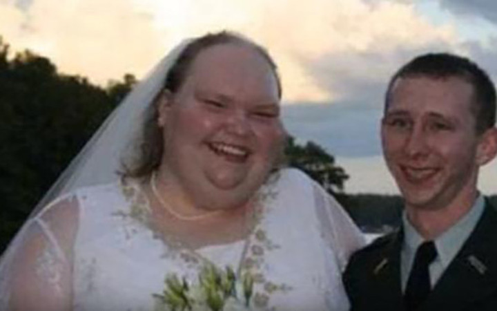 'Dünyanın en çirkin geliniydi' son hali şaşırttı