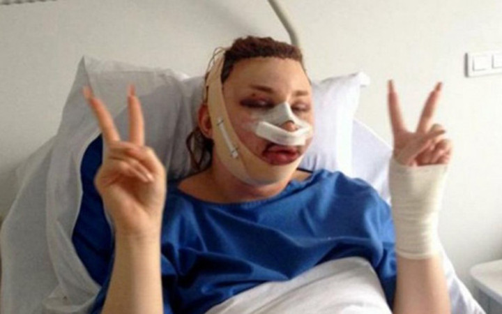 Şişme kadına benzemek için binlerce dolar harcadı!