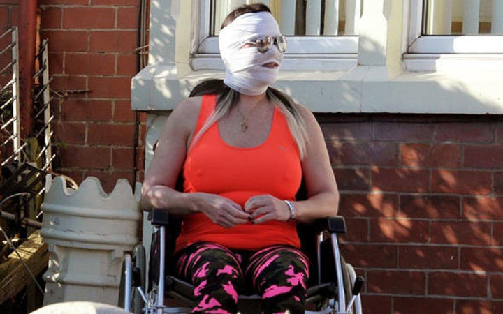 Kaza geçirmedi güzelleşmek istedi! Ünlü isim tanınmaz halde