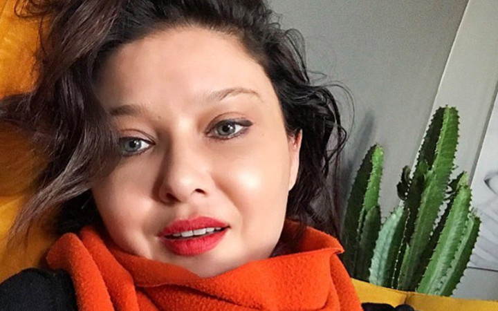 Botokslu hali korkunçtu! Nurgül Yeşilçay'ın inanılmaz değişimi