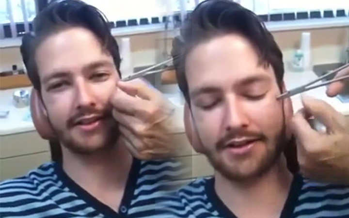 Yüzünden çıkanı görünce gözlerinize inanmayacaksınız