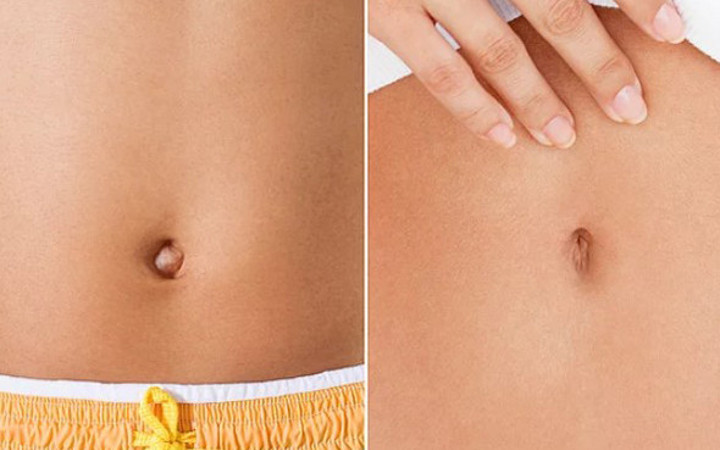 Şimdi bu estetikler moda! İşte acayip yerlere düzeltmeler