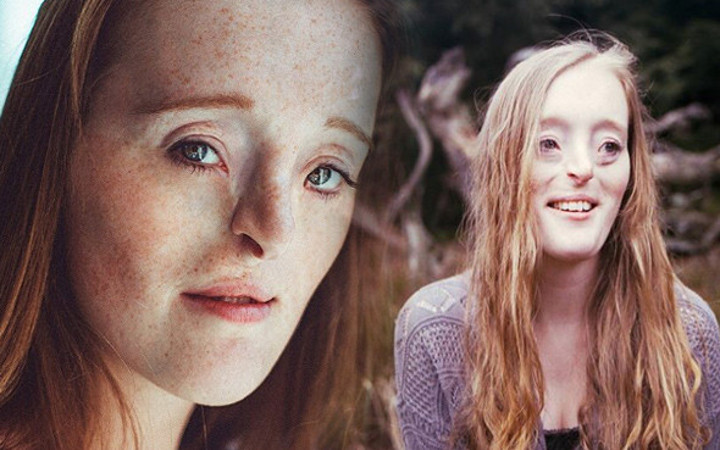 O artık dünyanın en ünlü modellerinden korkup kaçıyorlardı