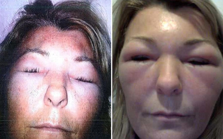 Türk doktor İngiltere'yi karıştırdı! Kadınların haline bakın