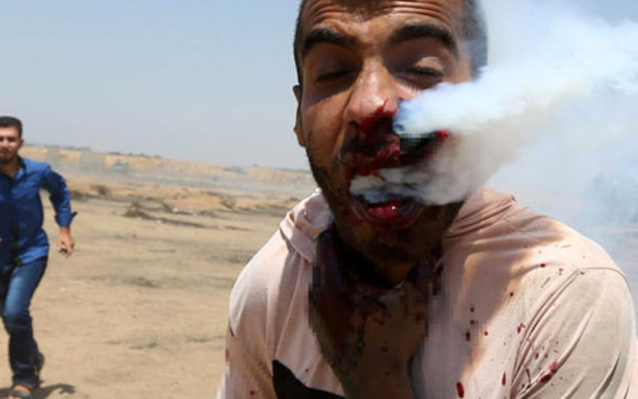 Korkunç görüntüler! 100'den fazla yaralı var