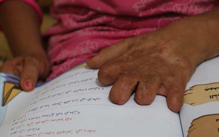 Derisi koyun derisi gibi soyuluyor acılar içinde yaşıyor!