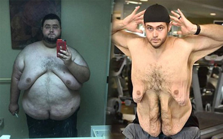 244 kilodan 136 kiloya düştü bambaşka birine döndü! Son haline bakın...