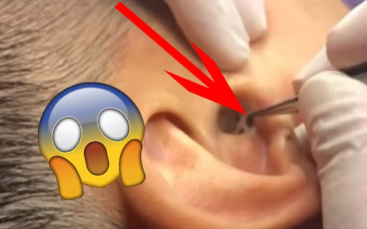 Midesi olan bakabiliyor kulağından çıkan şey tam 4 başlı...