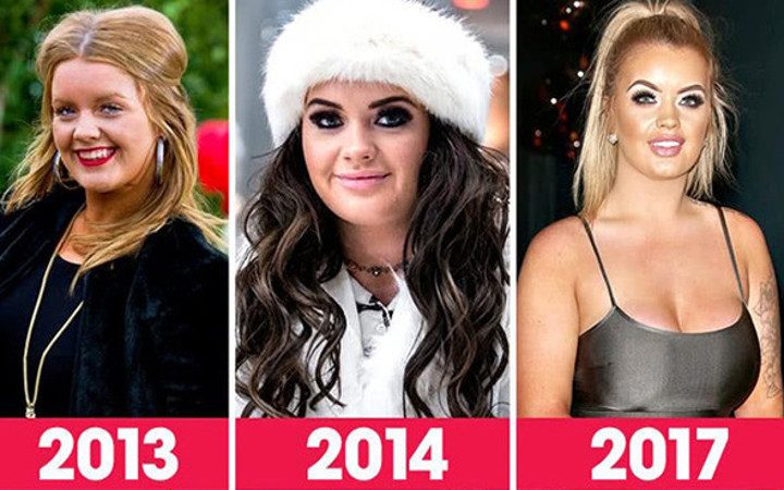 Loto'dan 8 milyon TL kazandı parayı estetiğe yatırdı! Şimdi bambaşka biri!