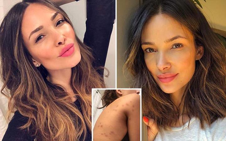 Kaldığı otel Victoria's Secret modelinin hayatını kabusa döndürdü!