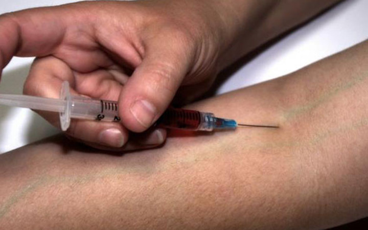 18 ay boyunca koluna sperm enjekte etti! Bakın sonrasında ne oldu