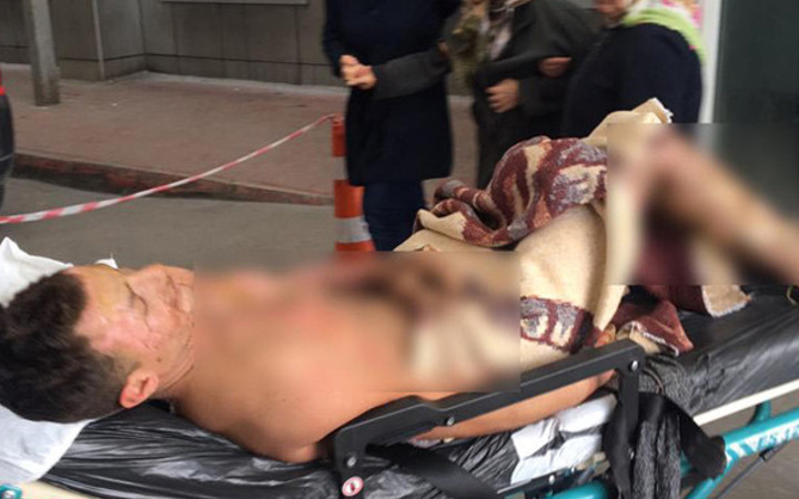 15 yaşındaki Ömer Demir feci şekilde yandı